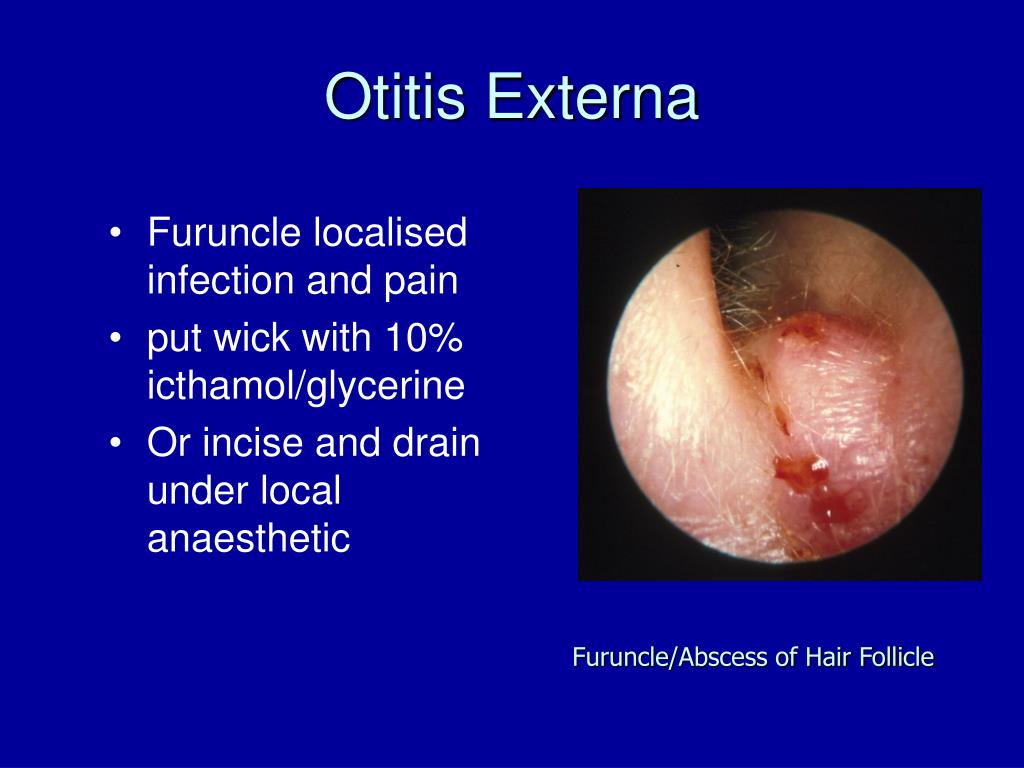 PPT ENT Undergraduate Lecture PowerPoint Presentation, free download