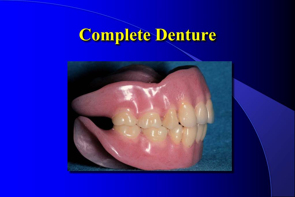 PPT Complete Denture PowerPoint Presentation, free download ID6081253