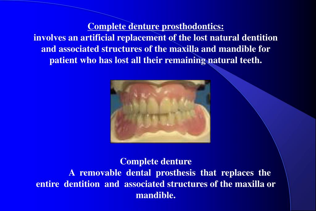 PPT Complete Denture PowerPoint Presentation, free download ID6081253