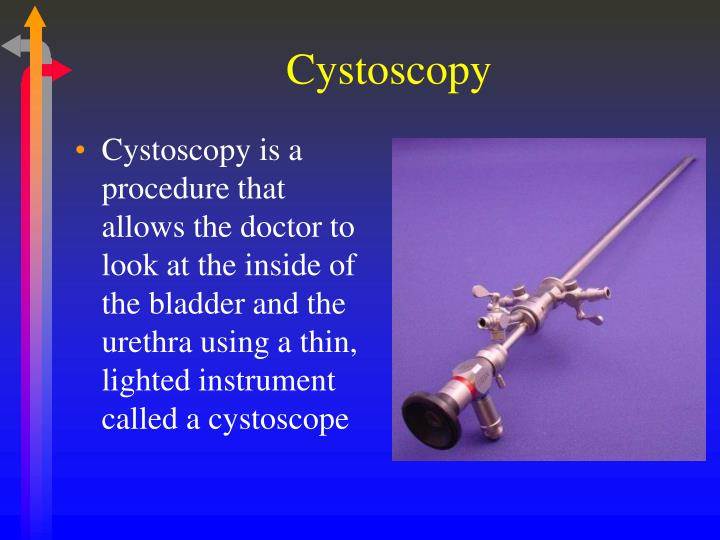 PPT GU Procedures Operative Sequence PowerPoint Presentation ID6084441