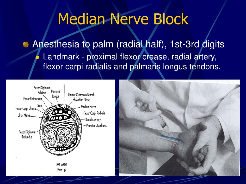 PPT Nerve Blocks PowerPoint Presentation, free download ID6088129