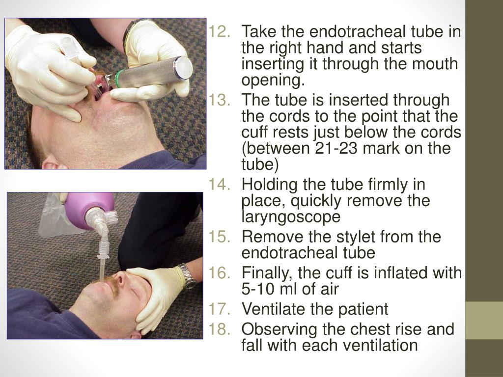 PPT Endotracheal Intubation PowerPoint Presentation, free download