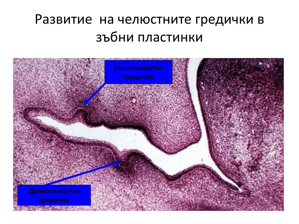 PPT Dental germ PowerPoint Presentation, free download ID6096059