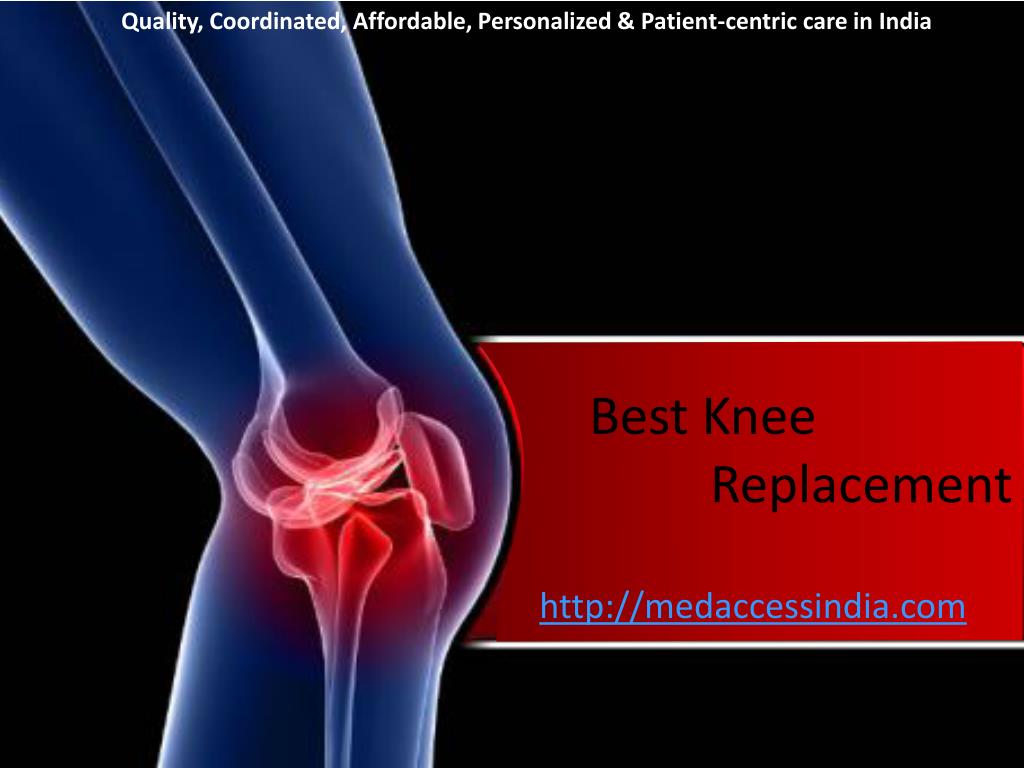 PPT Best knee replacement PowerPoint Presentation, free download ID