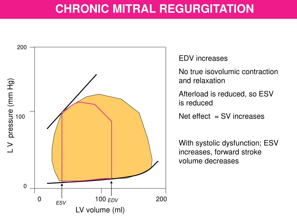 PPT VENTRICULAR PRESSURE VOLUME LOOP PowerPoint
