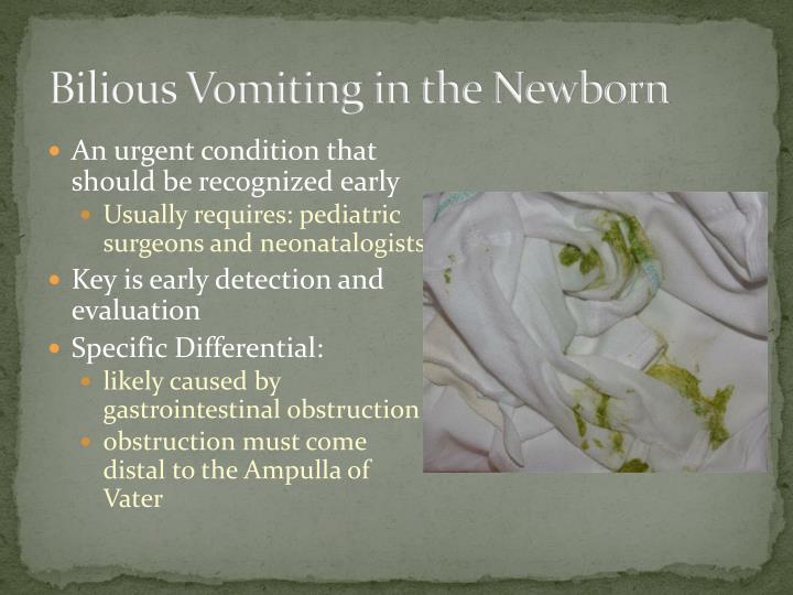 Is It Normal For Newborn To Vomit Once A Day at Karen Coll blog