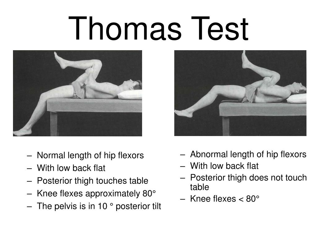 PPT The Thigh and Hip Muscles Anatomy, Injuries and Assessment