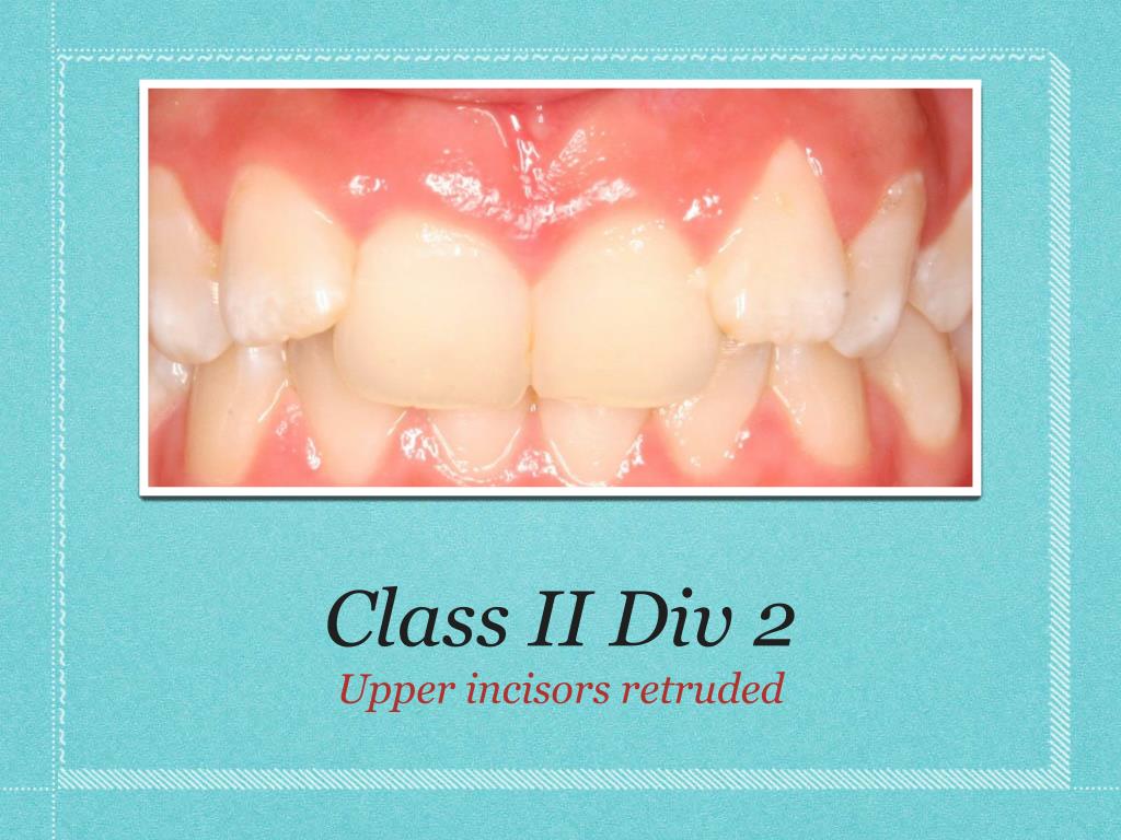 PPT Adult Class II Div. 2 Patient of Sunpark Dental and Wayne K Smith