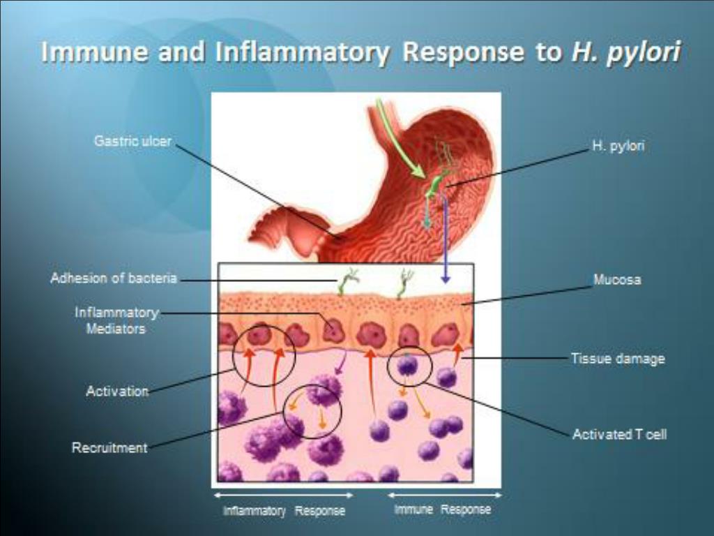 PPT Helicobacter pylori update PowerPoint Presentation, free download