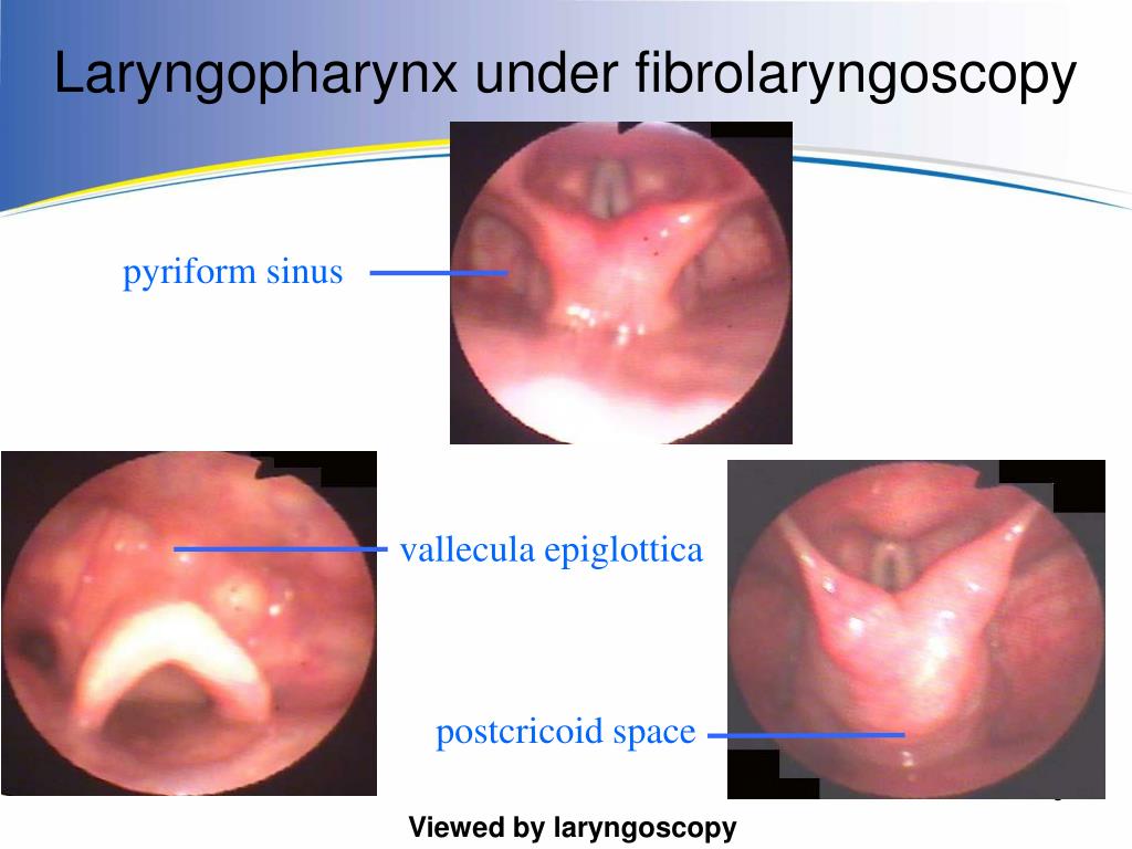 PPT Department of Otolaryngology Ruijin Hospital School of Medicine