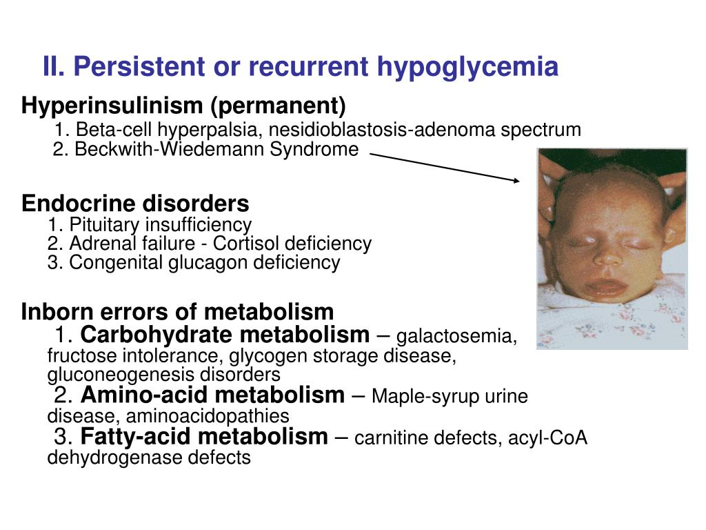 PPT Hypoglycemia in Newborn Infants PowerPoint Presentation, free