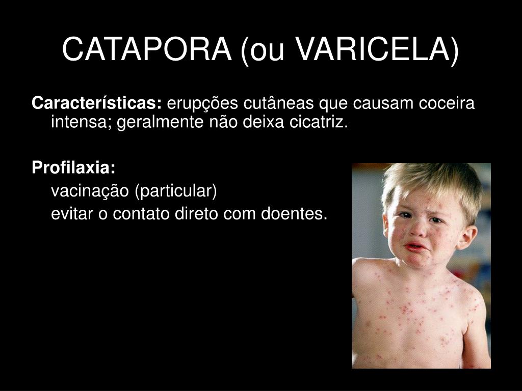 PPT Vírus e Viroses PowerPoint Presentation, free download ID6503620