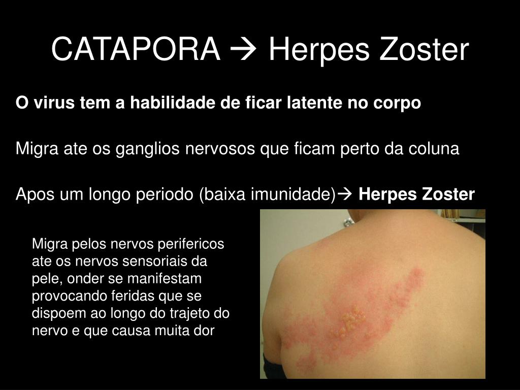 PPT Vírus e Viroses PowerPoint Presentation, free download ID6503620