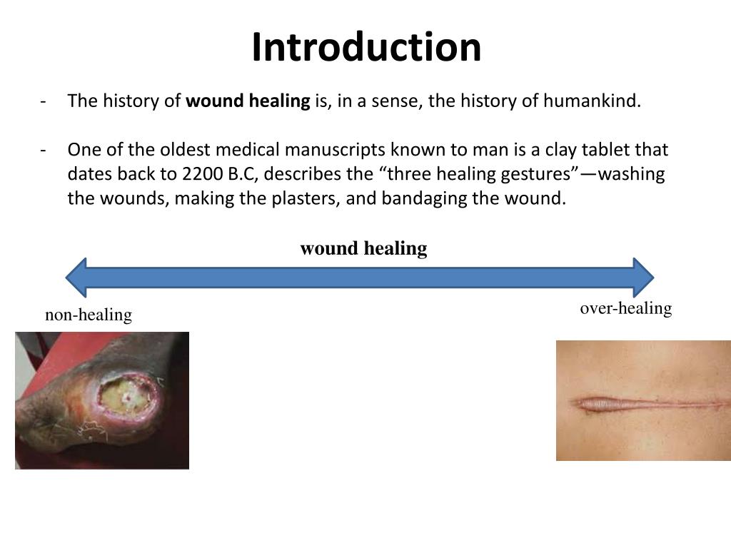 PPT Identifying Keratinocyte Derived Collagen Inhibitory Factors to