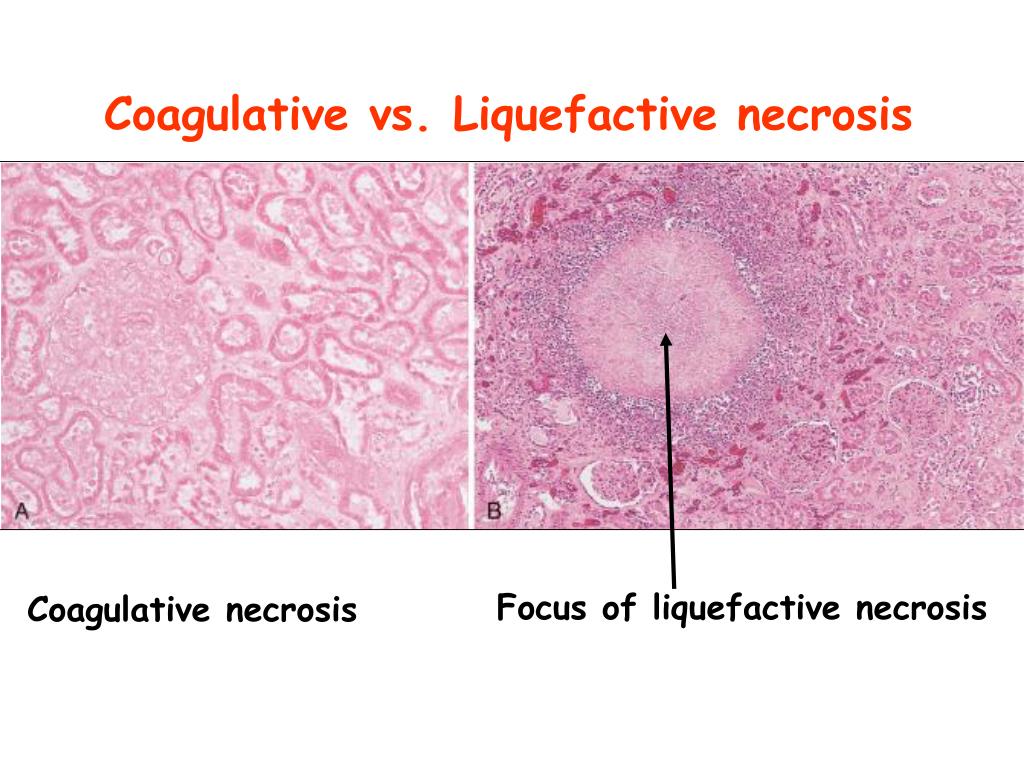 PPT Cell injury PowerPoint Presentation, free download ID6517954