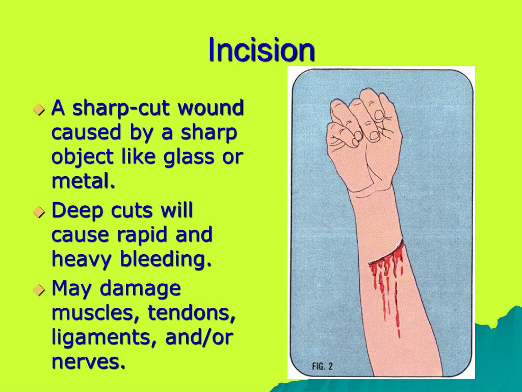 PPT Chapter 4 PowerPoint Presentation, free download ID6518358