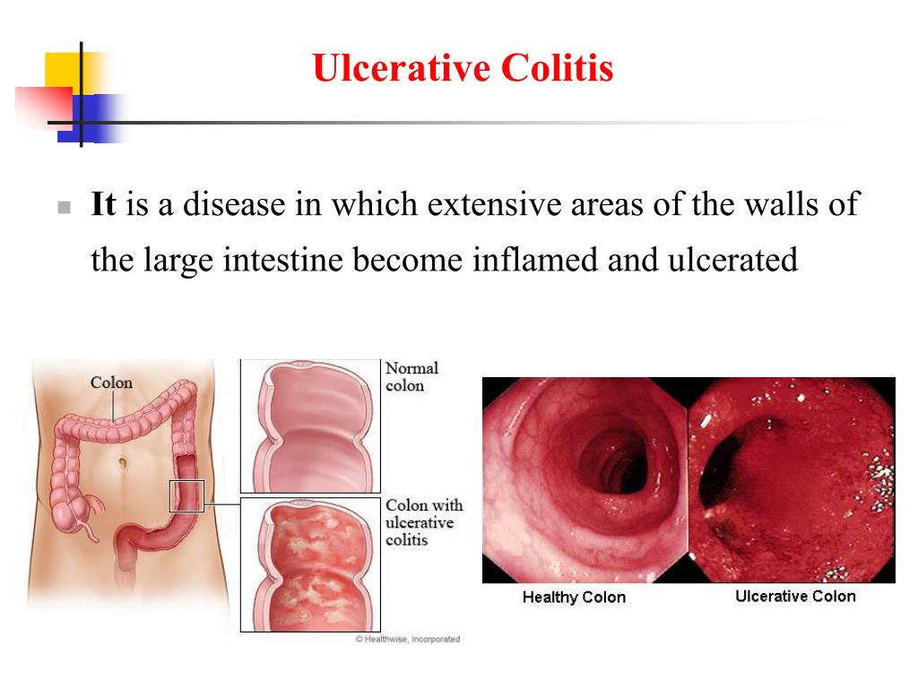 PPT Physiology of Gastrointestinal Disorders PowerPoint Presentation