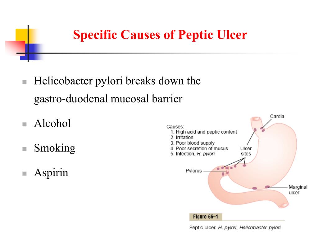 PPT Physiology of Gastrointestinal Disorders PowerPoint Presentation ID6555884
