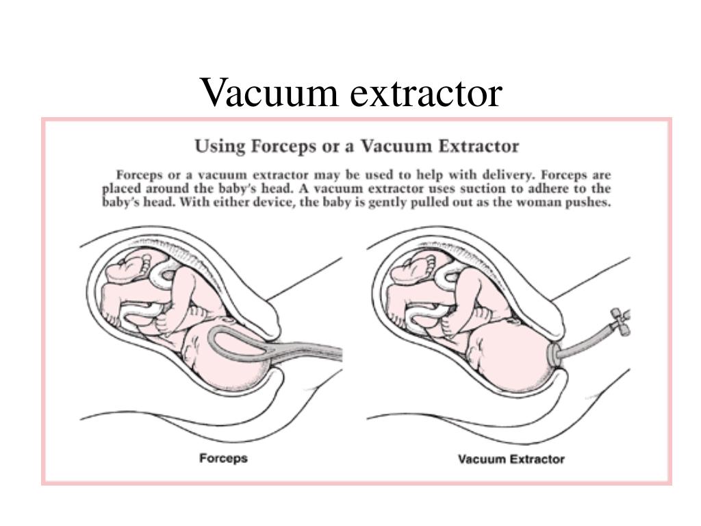 PPT Placenta PowerPoint Presentation, free download ID6569468