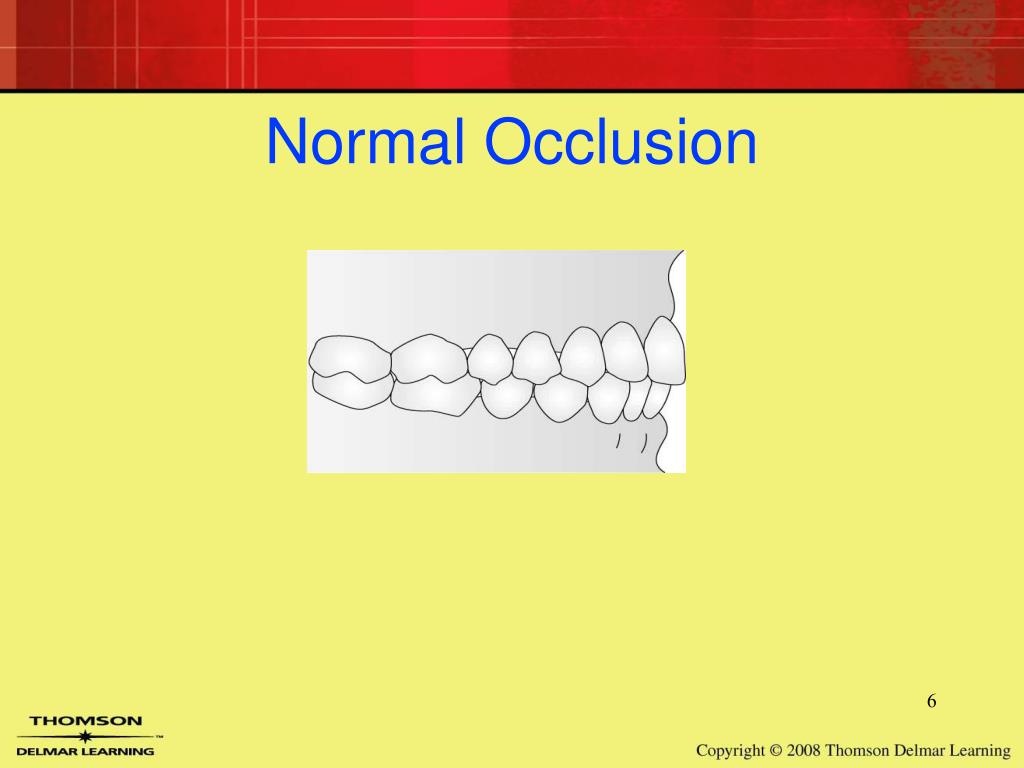 PPT Orthodontics PowerPoint Presentation, free download ID6569749