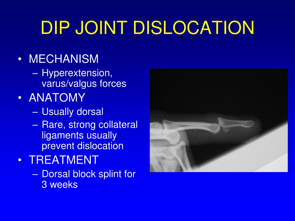 PPT Hand and Wrist Injuries PowerPoint Presentation, free download