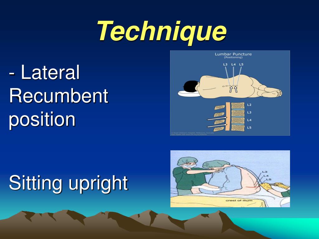 PPT Lumbar Puncture Indications and Procedure PowerPoint
