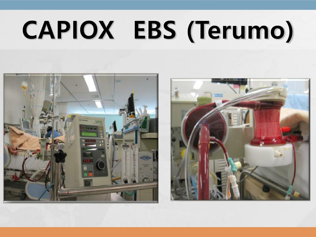 PPT ECMO (U nderstanding and Management ) PowerPoint Presentation