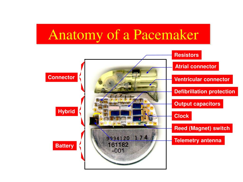 PPT BASICS OF PACEMAKER PowerPoint Presentation, free download ID