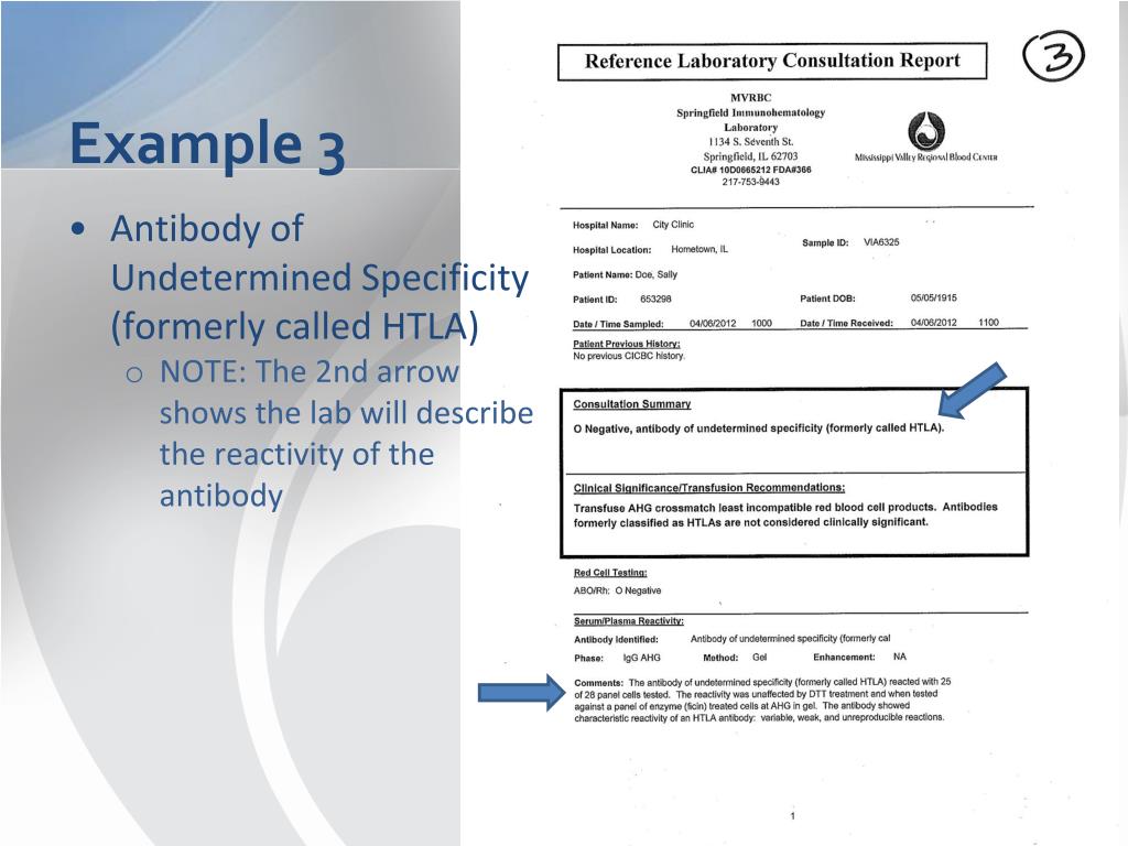 PPT Antibodies Formerly Known as ‘HighTiter, LowAvidity (HTLA