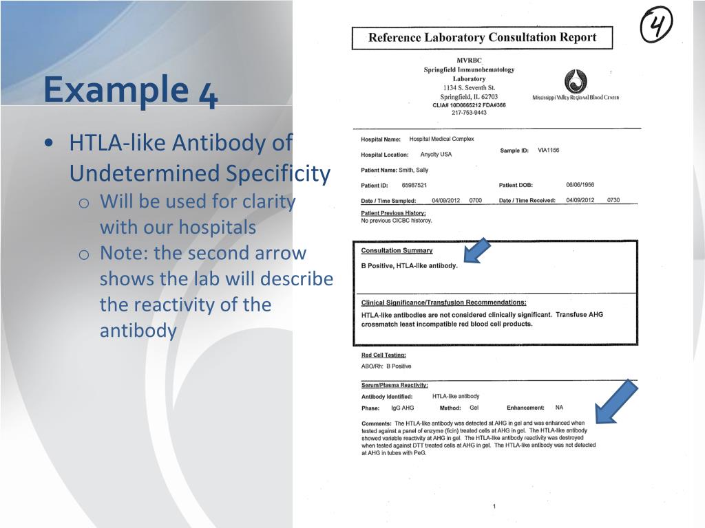 PPT Antibodies Formerly Known as ‘HighTiter, LowAvidity (HTLA