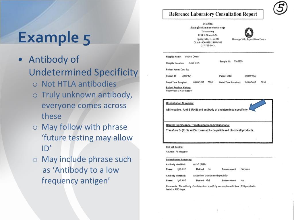 PPT Antibodies Formerly Known as ‘HighTiter, LowAvidity (HTLA