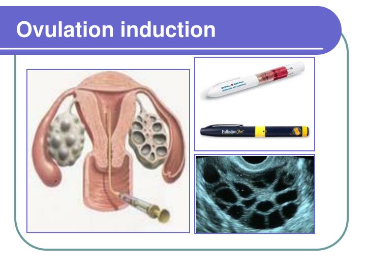 PPT Preimplantation Diagnosis (PGD) PowerPoint Presentation