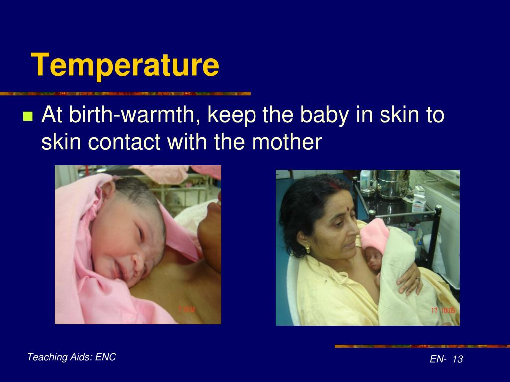 PPT Examination of the newborn baby PowerPoint Presentation, free