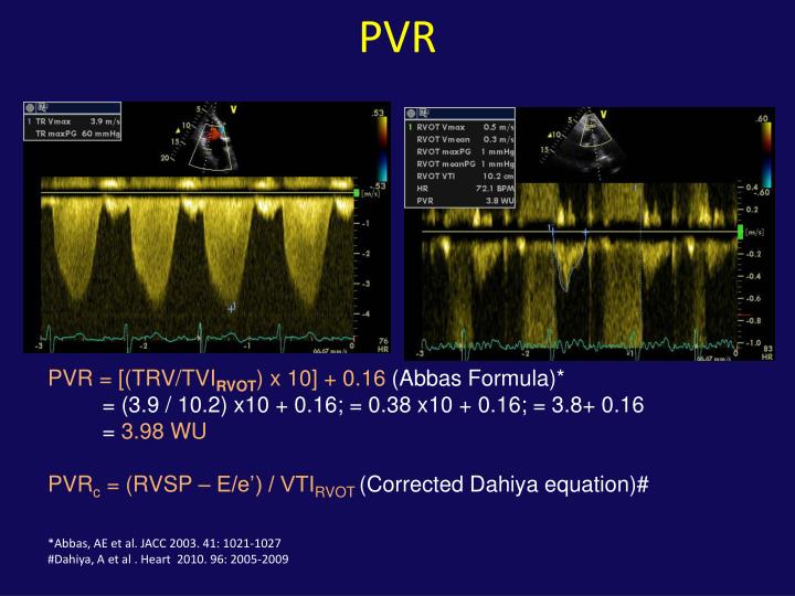 PPT Role of the Echocardiogram in the Assessment of
