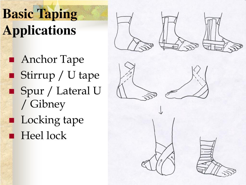 PPT PRINCIPLES OF SPORTS TAPING PowerPoint Presentation, free