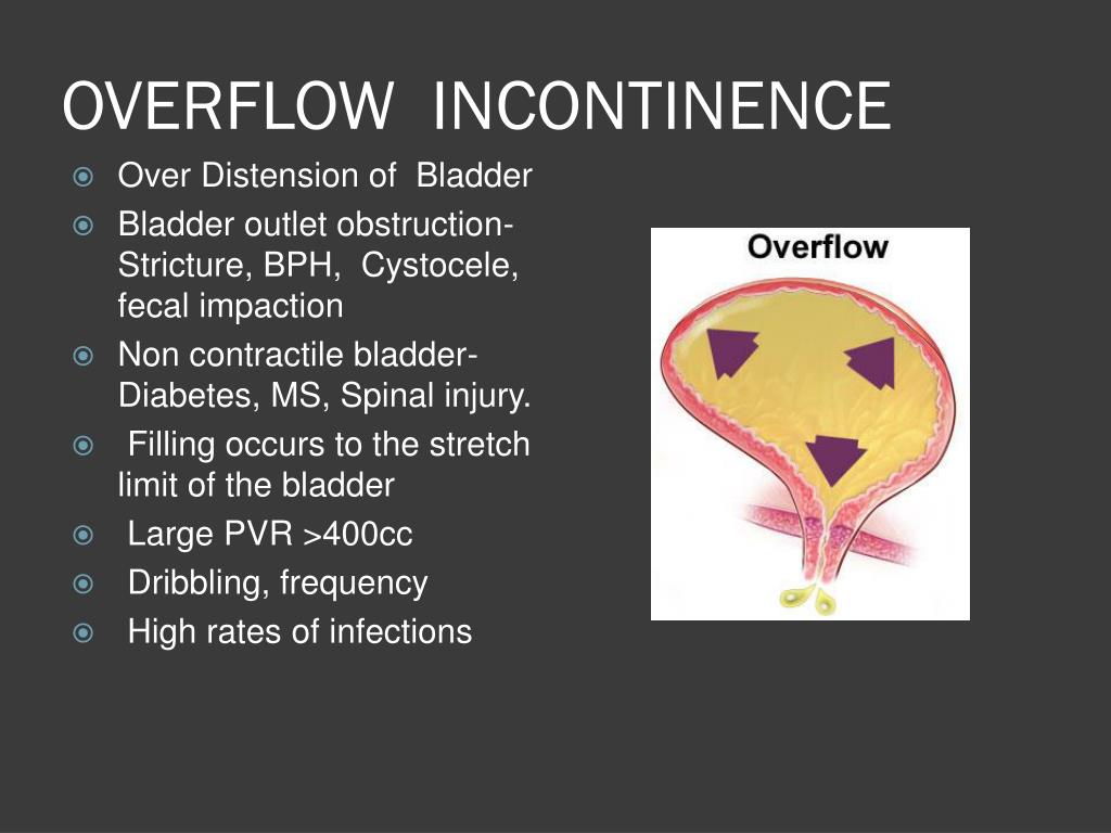 Overflow Incontinence Woman at Judy Trumbauer blog