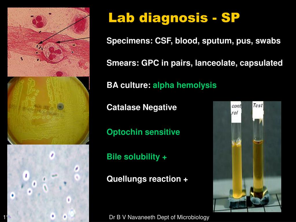 PPT Gram Positive Cocci (GPC) PowerPoint Presentation, free download