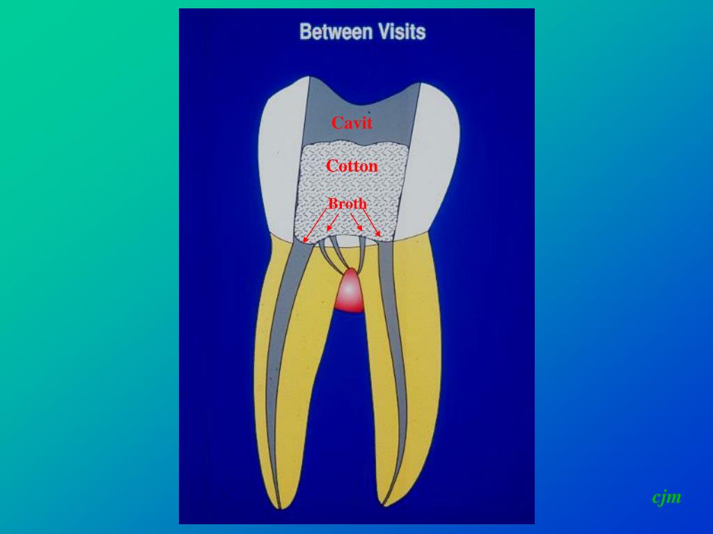 PPT Hess PowerPoint Presentation, free download ID6670160