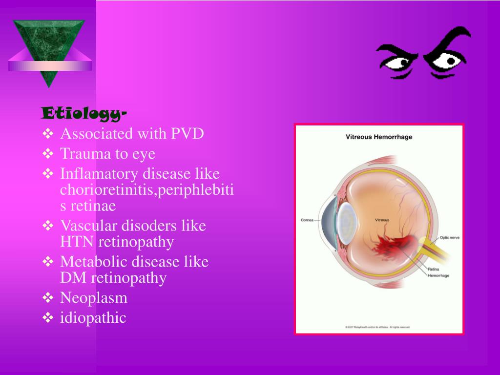 PPT Sudden Painless Loss Of Vision PowerPoint Presentation, free
