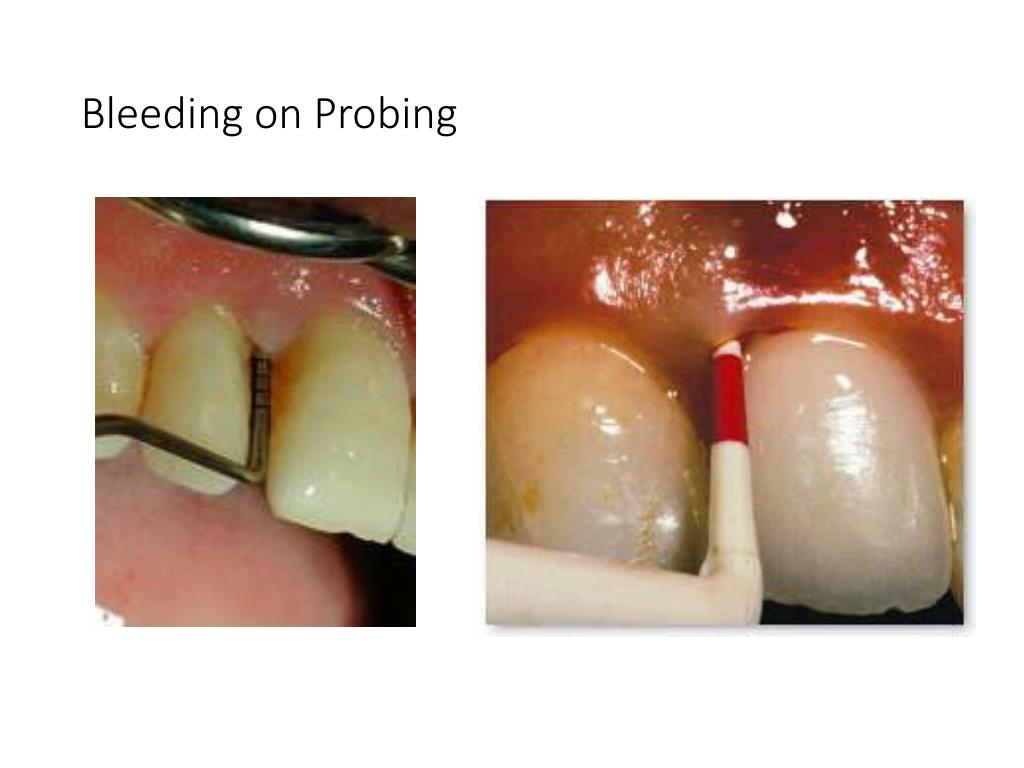 PPT Assessment Instruments Explorers and Probes PowerPoint