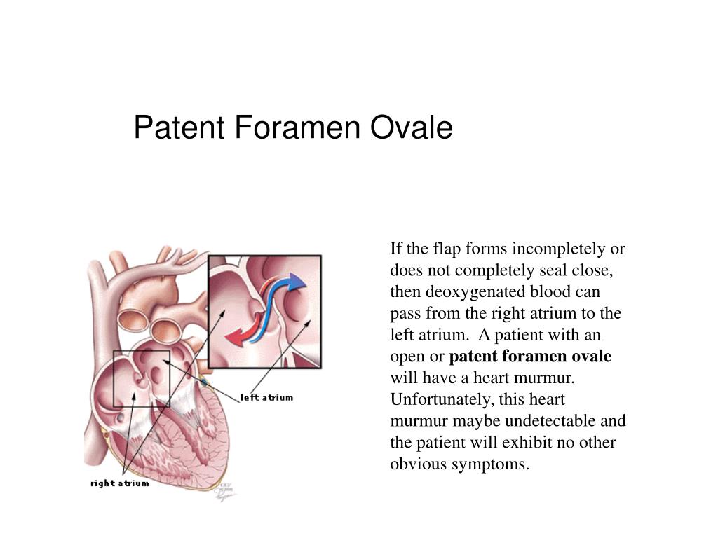 PPT Patent Ductus Ateriosis PDA Muhammad Syed MD PowerPoint Presentation ID6702231