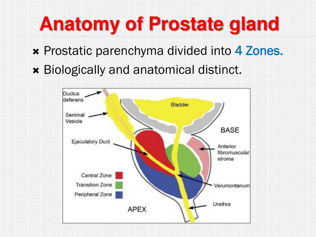 PPT Benign prostatic Hyperplasia PowerPoint Presentation, free