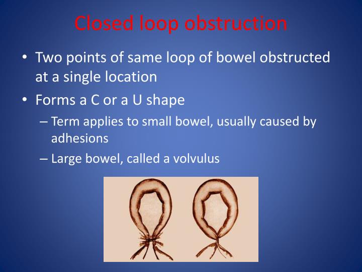 PPT Abdominal Xray Radiological Signs PowerPoint Presentation ID6717699