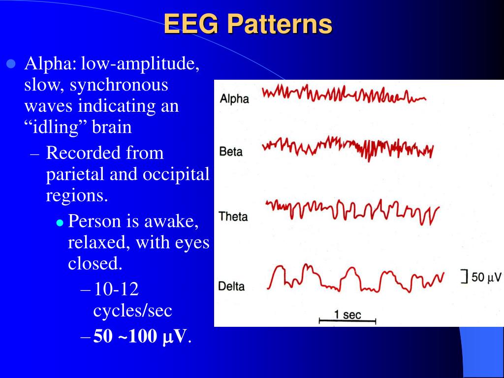 PPT Section 6 Electroencephalogram (EEG), Wakefulness and Sleep
