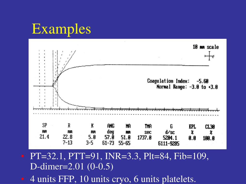 PPT Thromboelastography Applications in Anesthesia PowerPoint Presentation ID6734816