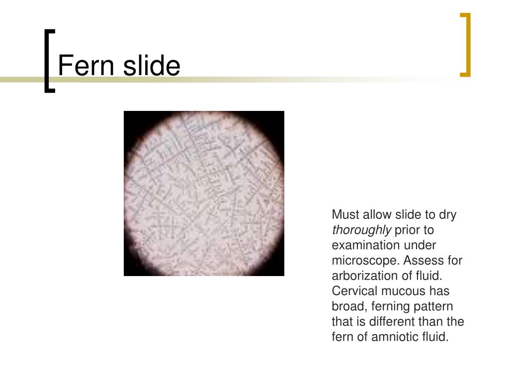 PPT Preterm Rupture of Membranes PowerPoint Presentation, free