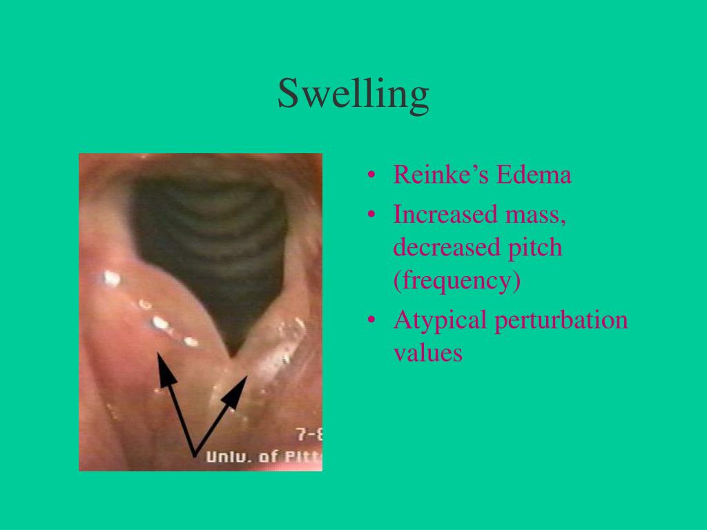 PPT Peter R. LaPine, Ph.D. Department of Audiology and Speech