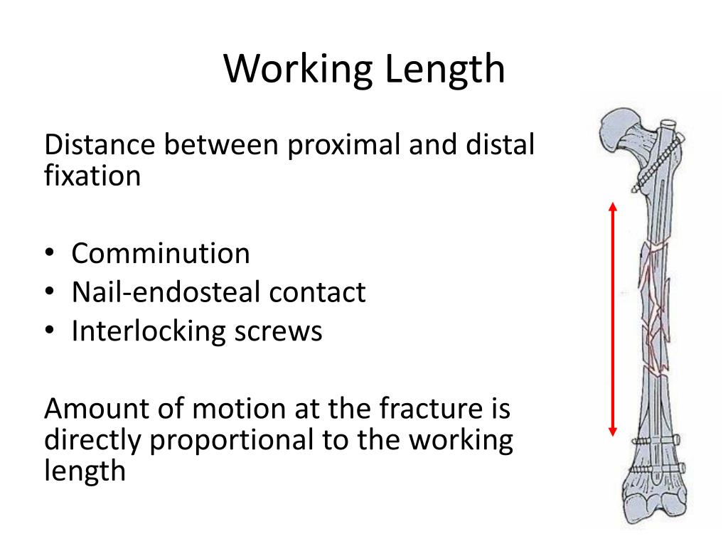 PPT Intramedullary Nail Mechanics PowerPoint Presentation, free