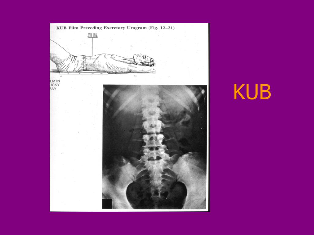 PPT BASIC GI RADIOLOGY THE “FLAT” PLATE PowerPoint Presentation, free