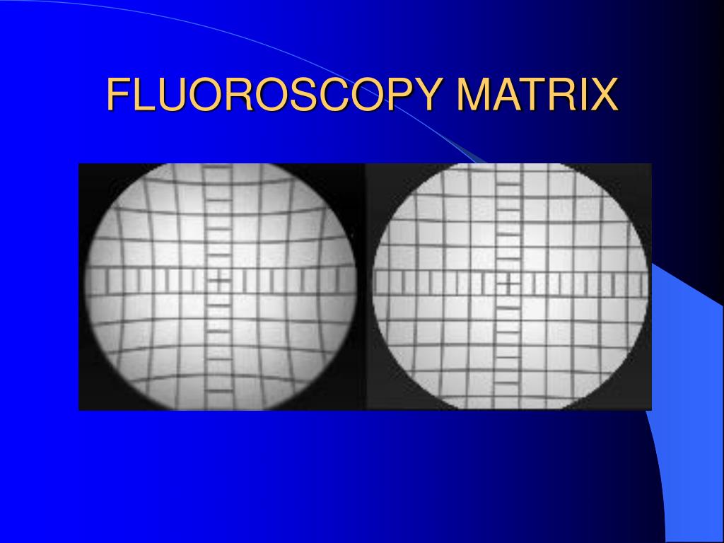 PPT DIGITAL FLUOROSCOPY PowerPoint Presentation, free download ID